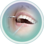 Profilaxia Dental